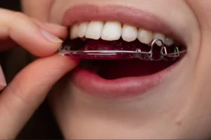 Hawley-Retainer