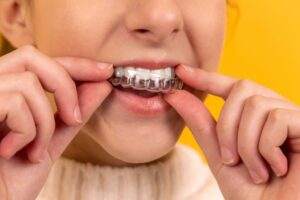 retainer 2